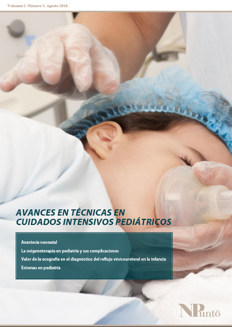 CPAP: Desarrollan dispositivos más eficientes y cómodos - Gasex